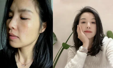 U40 “lột xác” ngoạn mục nhờ uống Collagen mỗi ngày
